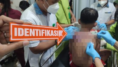 Polisi Memburu Pelaku Penyiraman Air Keras Terhadap Ibu dan Anak, di Sukabumi