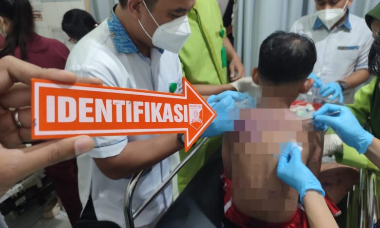 Polisi Memburu Pelaku Penyiraman Air Keras Terhadap Ibu dan Anak, di Sukabumi Polisi Memburu Pelaku Penyiraman Air Keras Terhadap Ibu dan Anak, di Sukabumi