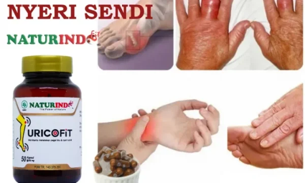 Akhirnya Terungkap! 5 Obat Untuk Asam Urat Paling Ampuh yang Wajib Kamu Coba di 2026