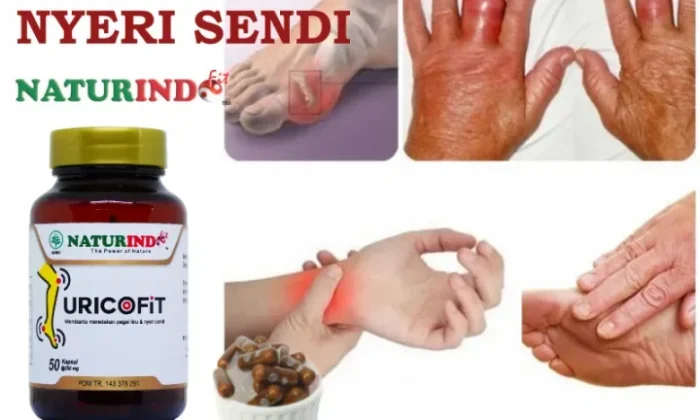 Akhirnya Terungkap! 5 Obat Untuk Asam Urat Paling Ampuh yang Wajib Kamu Coba di 2026