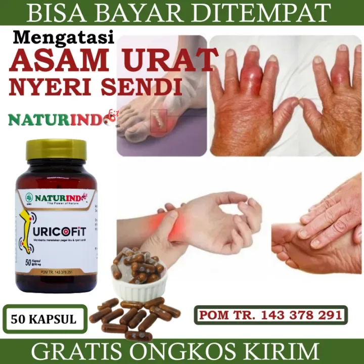 Obat Asam Urat Nyeri Sendi Kaki Bengkak Kaki terasa Panas Rematik