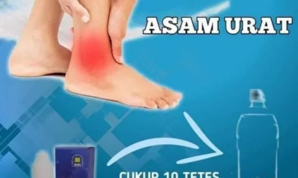 Rahasia 3 Obat Paten Asam Urat Terbaru 2026 Terbukti Ampuh Atasi Nyeri Persendian Anda